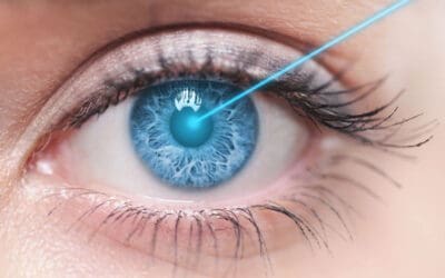 Is LASIK Surgery Right for You? Things to Consider