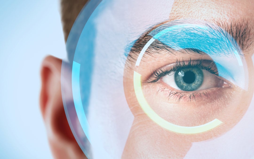 Eye with digital overlay illustration for determining if patient is good candidate for LASIK eye surgery in Pittsburgh.