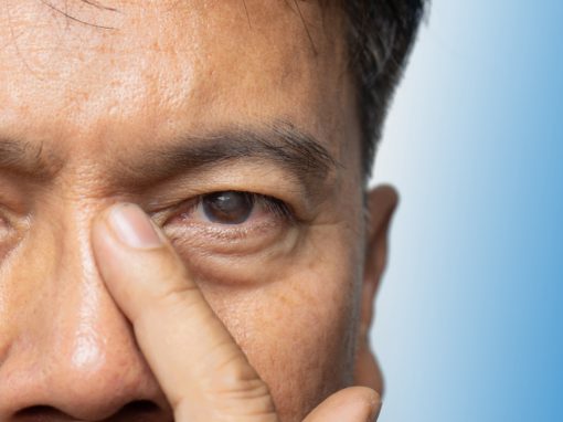 Senior man in Pittsburgh with early signs of cataracts affecting vision.