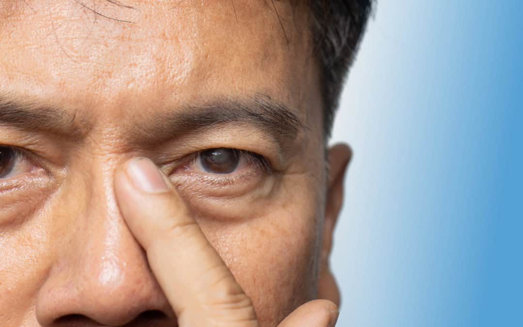 senior-man-pittsburgh-cataracts Senior man in Pittsburgh with early signs of cataracts affecting vision.