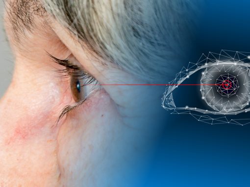 Chang Eye Group illustration of MIGS eye surgery in Pittsburgh.